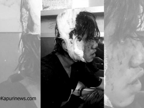 धरानको बिच बजारमा दिउँसै खुकुरी हानाहान हुँदा दुई युवा घाइते